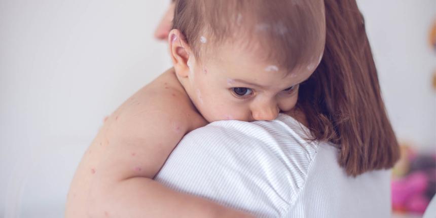 Hoe Kunnen Ouders Allergieën En Huidirritaties Bij Hun Babys Voorkomen Door De Juiste Kleding Te Kiezen?